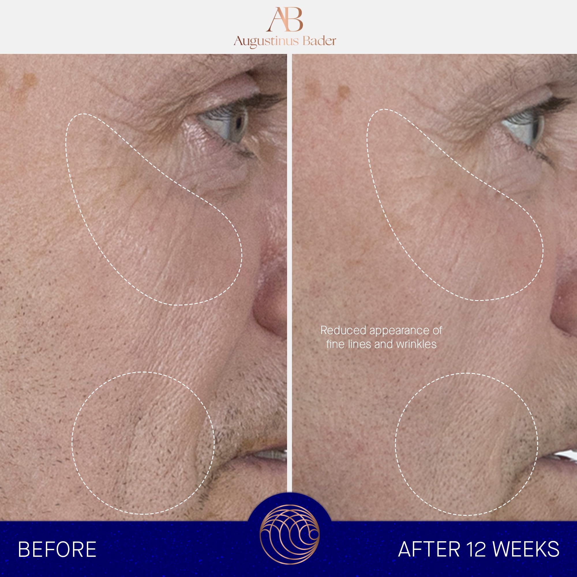 Augustinus Bader The Serum – Hydrating Anti-Aging Serum for Firmer, Smoother Skin (15 ml)