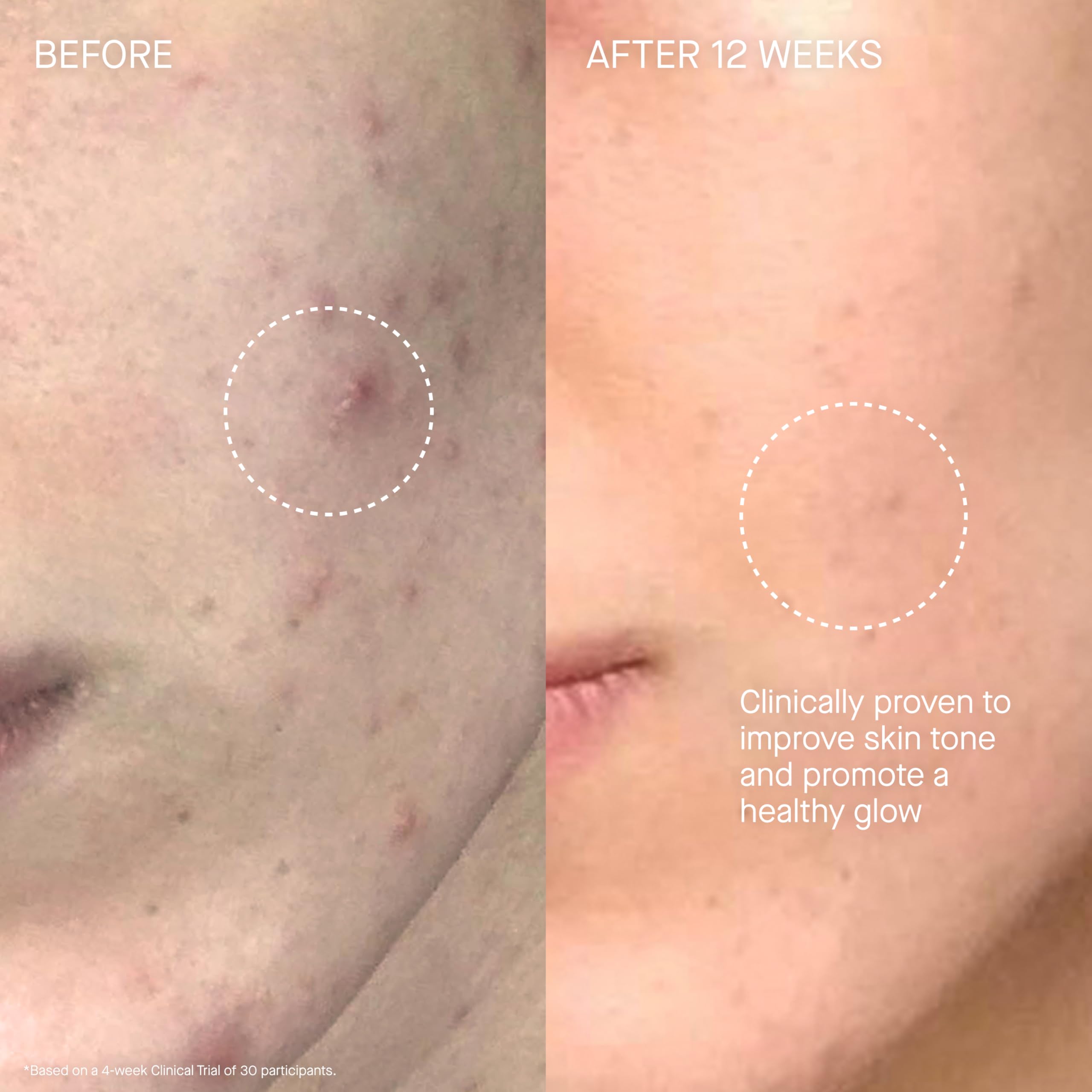 Augustinus Bader The Cream – Luxury Hydrating Face Moisturizer