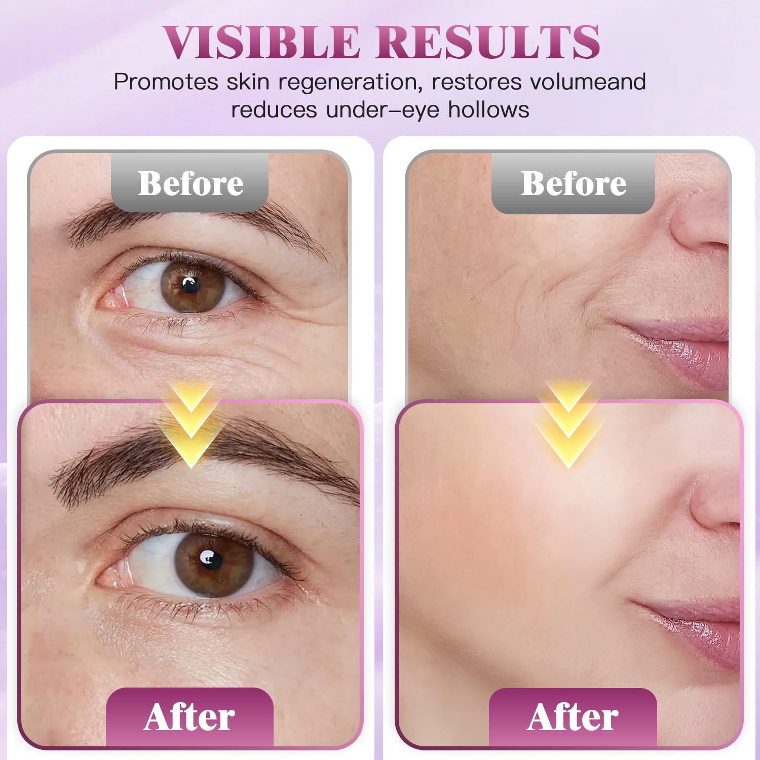 Auriela Calcium Volume Multi Balm Stick — Anti-Wrinkle, Hydration & Firming for Face, Eyes, Lips & Neck (4 pcs)