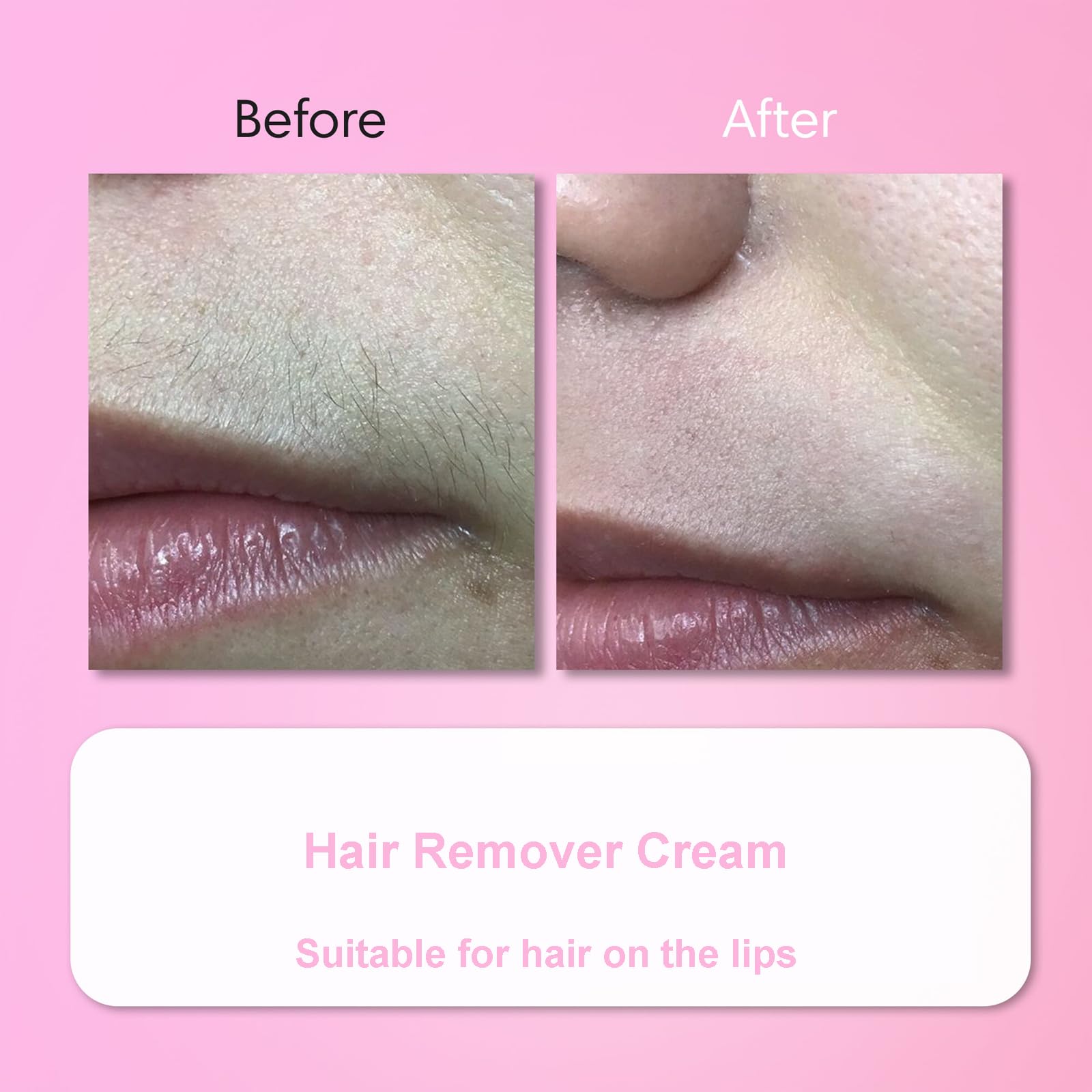Aurlux Hair Remover Cream for Face – 15-Minute Facial Hair Removal Kit