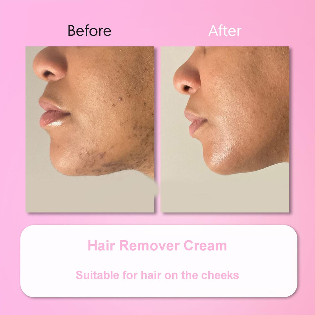 Aurlux Hair Remover Cream for Face – 15-Minute Facial Hair Removal Kit
