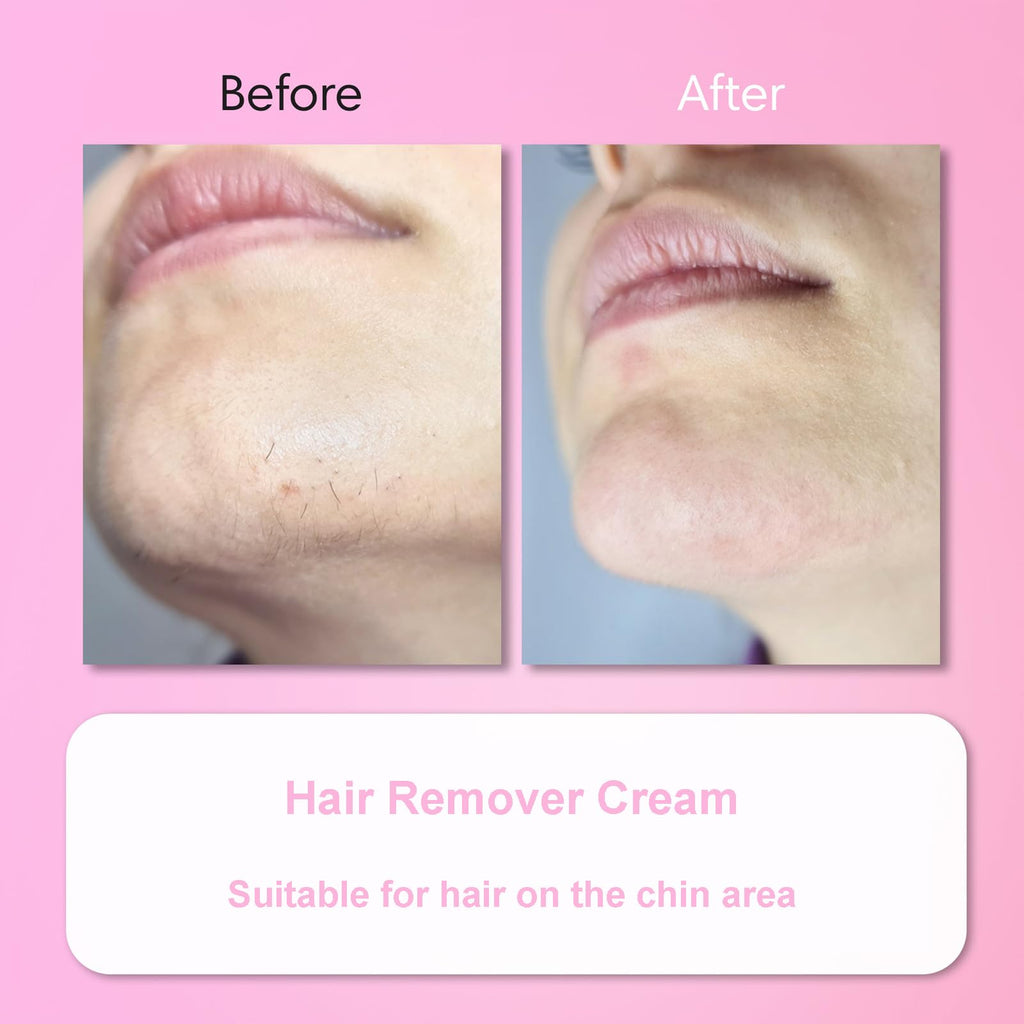 Aurlux Hair Remover Cream for Face – 15-Minute Facial Hair Removal Kit