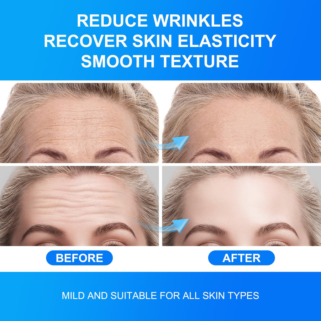 Auteek Forehead Wrinkle Patches Overnight – Collagen & Seaweed (20 Count)