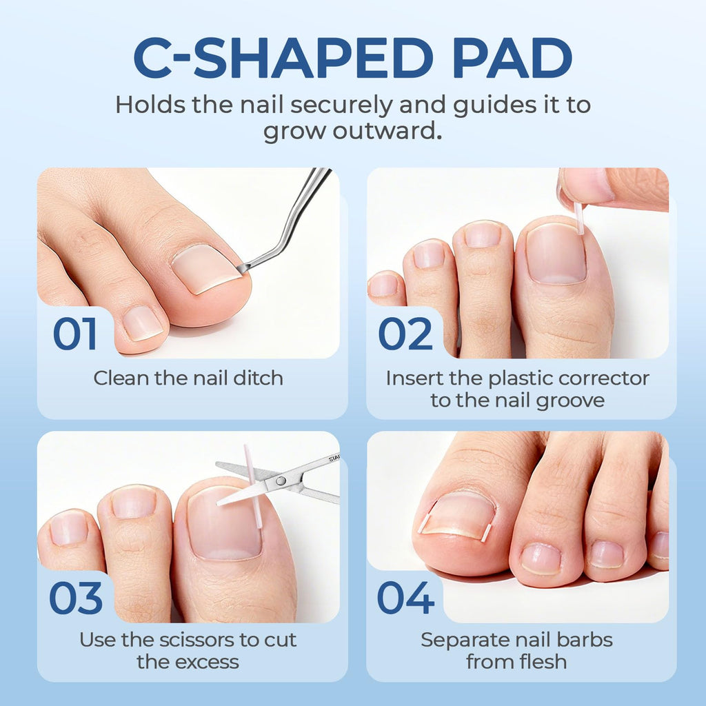 awrose Ingrown Toenail Corrector Set with Correction Strips | At-Home Pedicure Kit for Men & Women