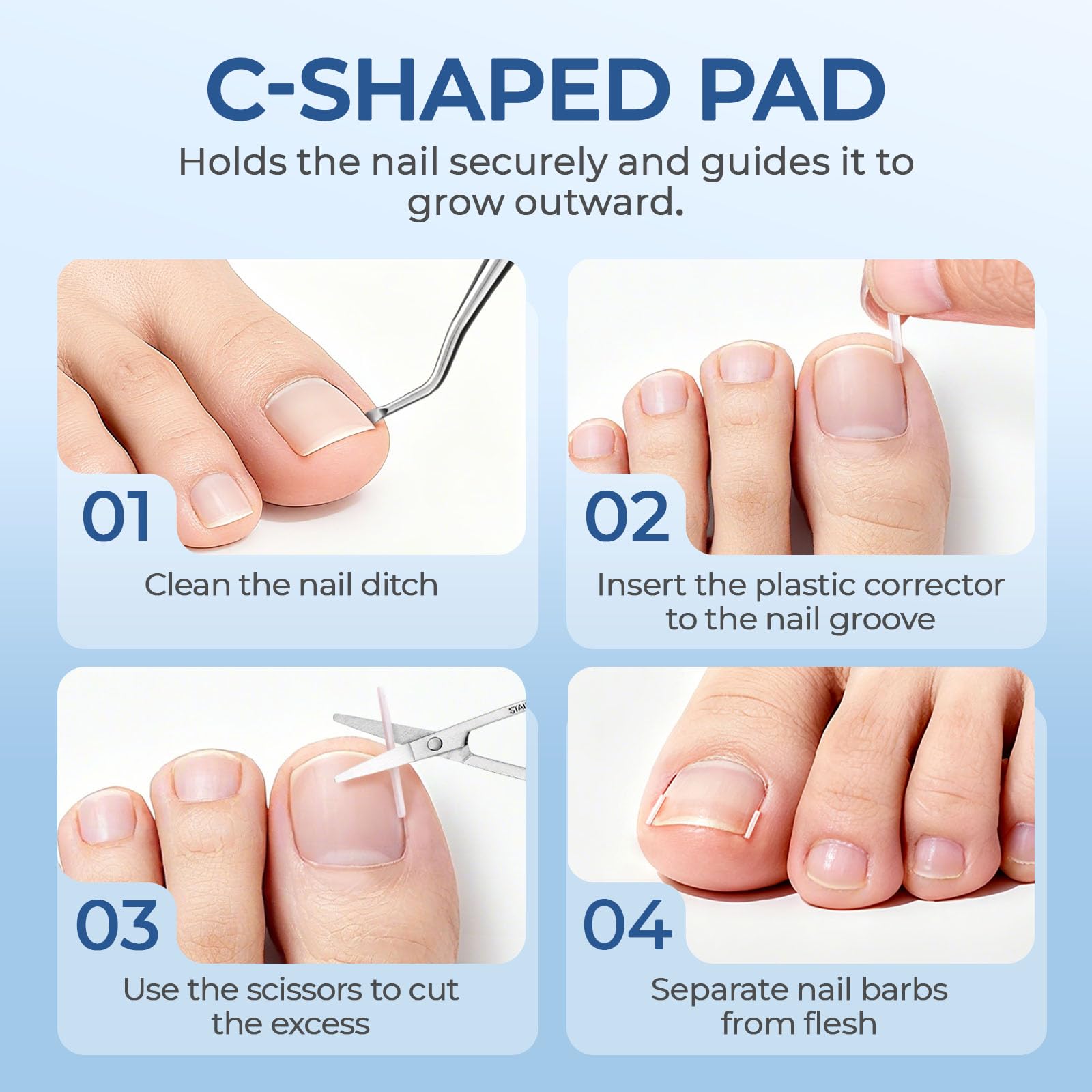 awrose Ingrown Toenail Corrector Set with Correction Strips | At-Home Pedicure Kit for Men & Women