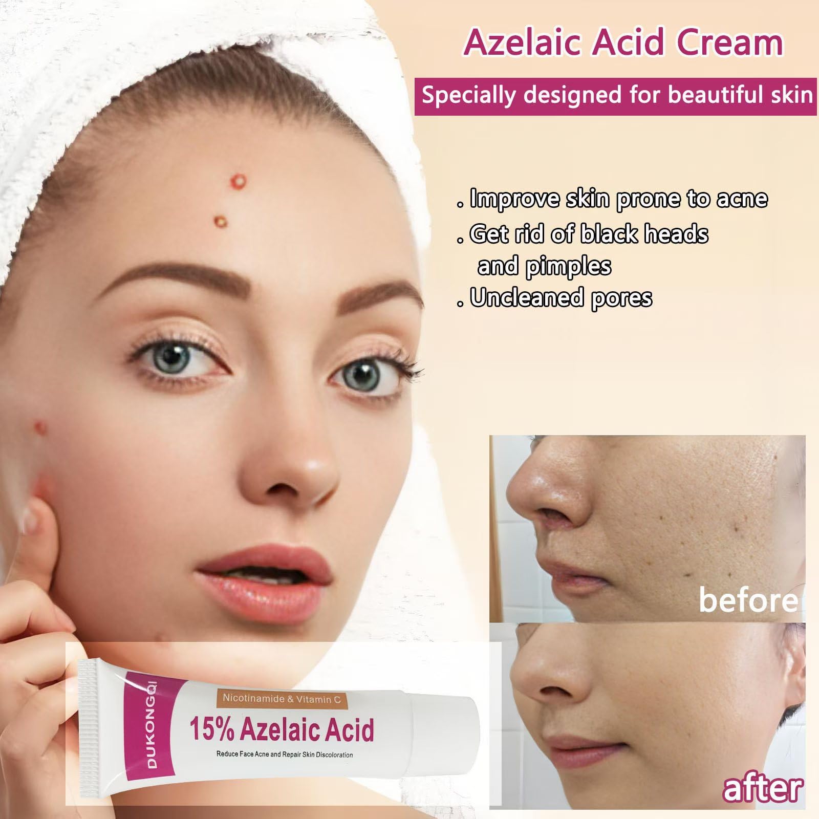 Azelaic Acid Serum 12% for Balanced Skin Tone & Purified Pores, 20g