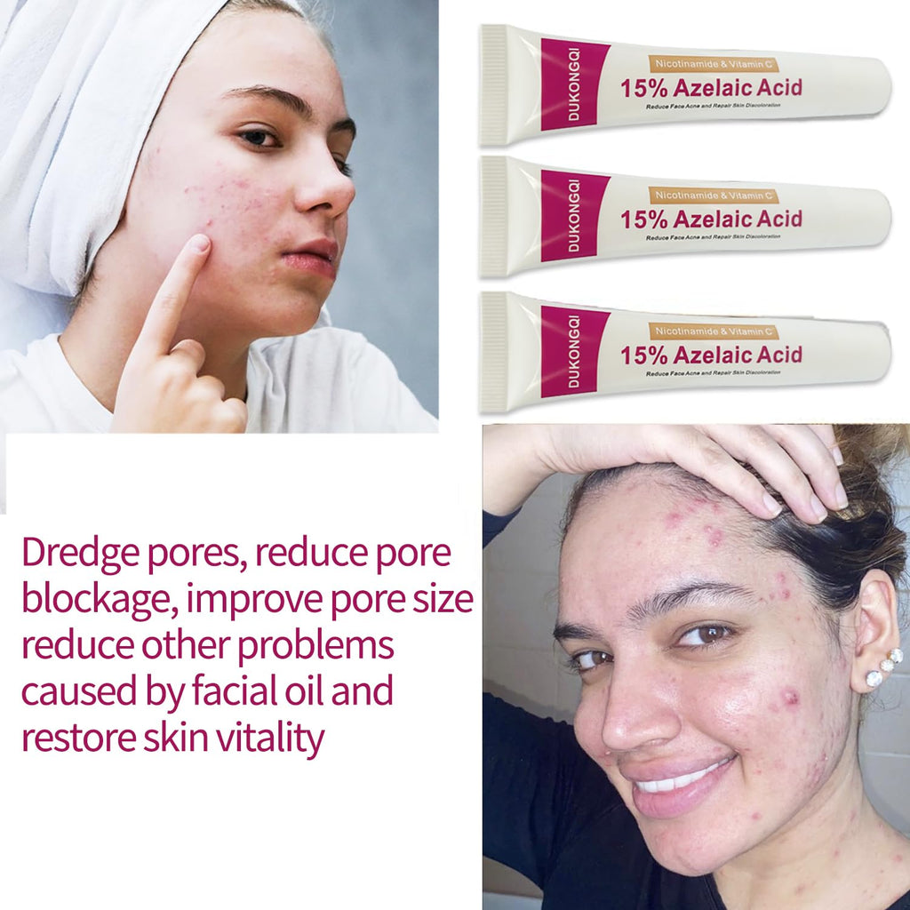Azelaic Acid Serum for Balanced Skin Tone & Clear Pores – Acne & Redness Relief, 20g
