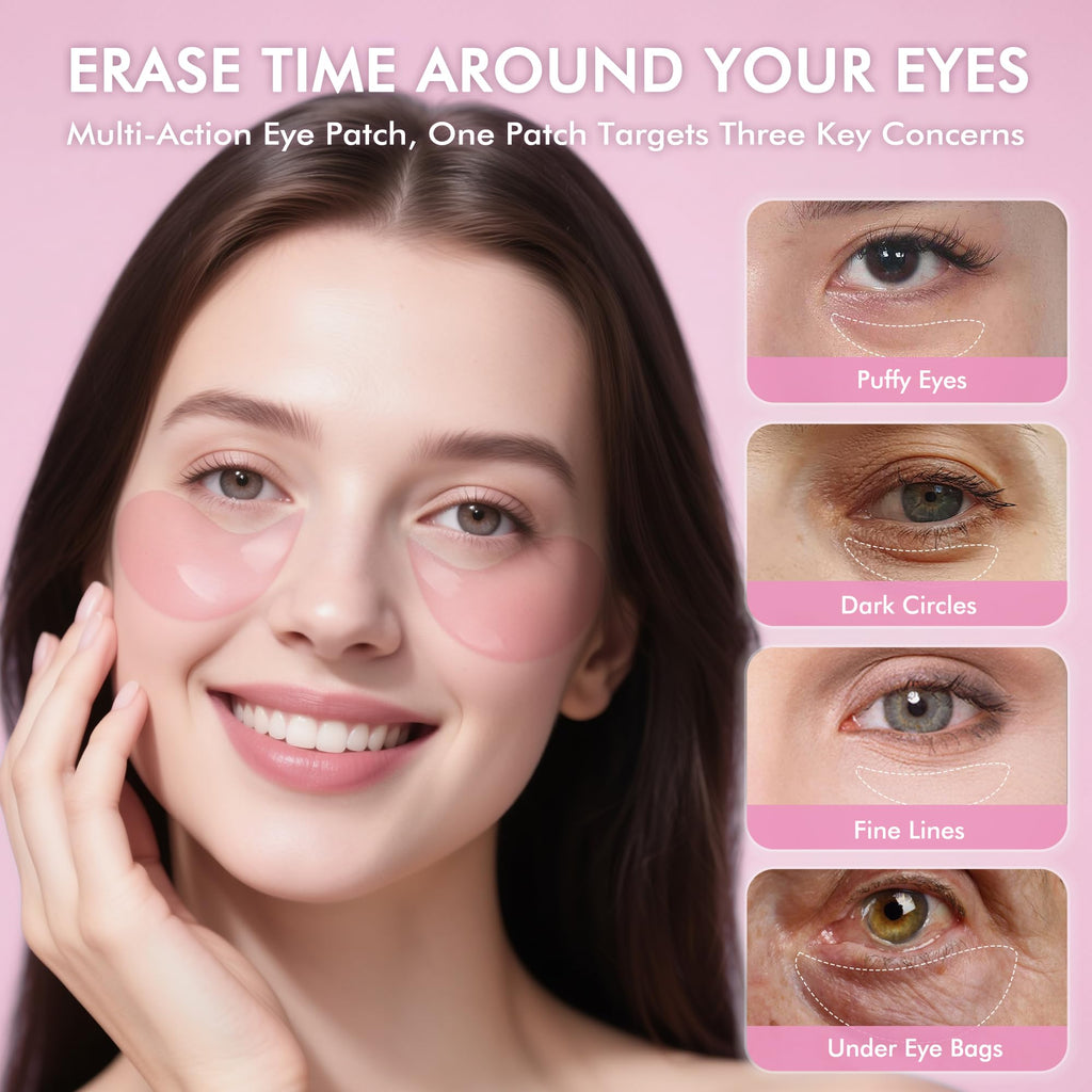 AzLucaky Rose Hydrogel Eye Patches — 40 Pairs for Puffy Eyes, Dark Circles, Hydration