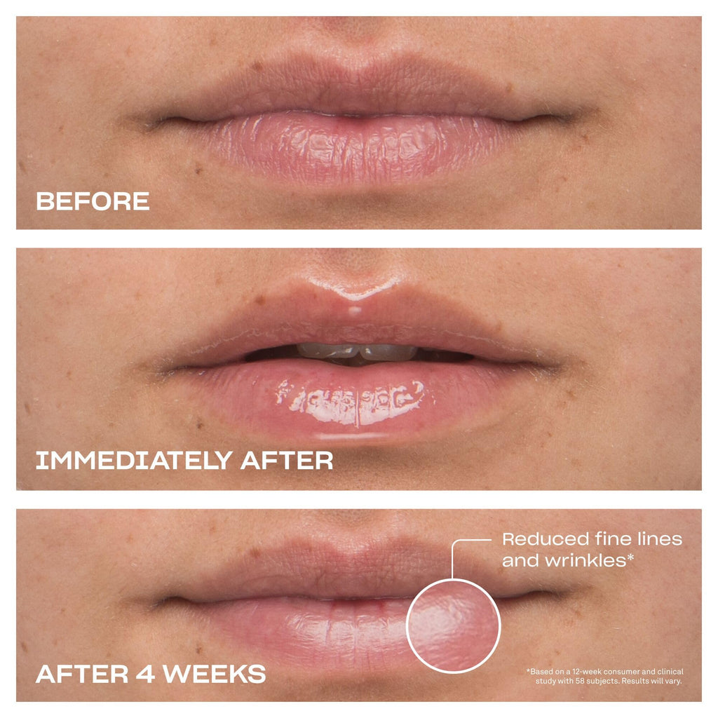 BABE ORIGINAL Cloud 9 Lip Serum | Hydrating Lip Treatment with Cloudberry Oil, Peptides & Hyaluronic Acid