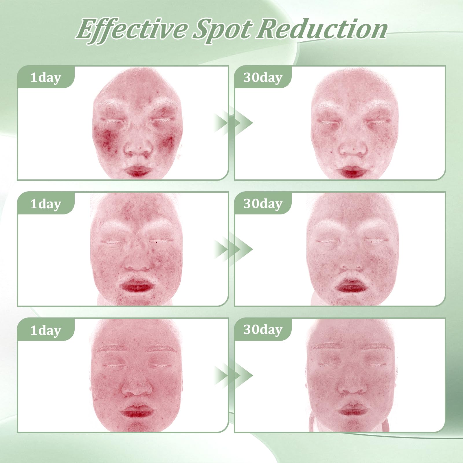 Bablabear 2% Salicylic Acid Acne Cream – Face, Back & Body (30g)