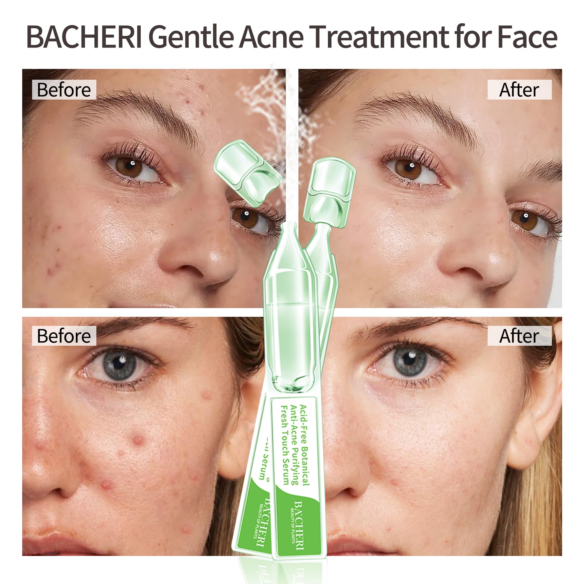 BACHERI Gentle Botanical Acne Serum – Niacinamide & Witch Hazel, 1.2 ml × 30 Ampoules