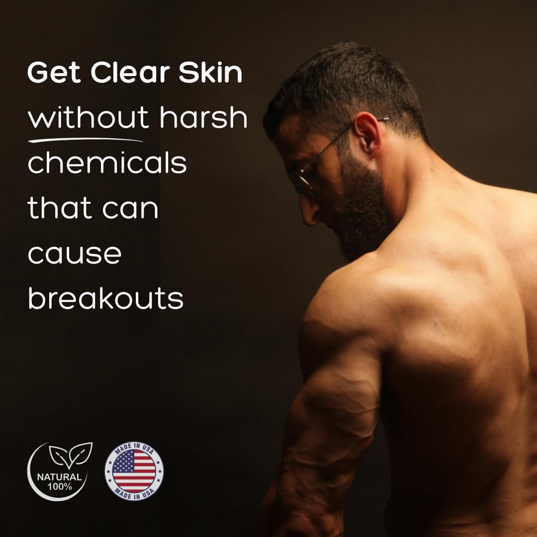 Bacne Bar Bacne Wash – All-Natural Back Acne Cleanser with Charcoal, Tea Tree & Jojoba