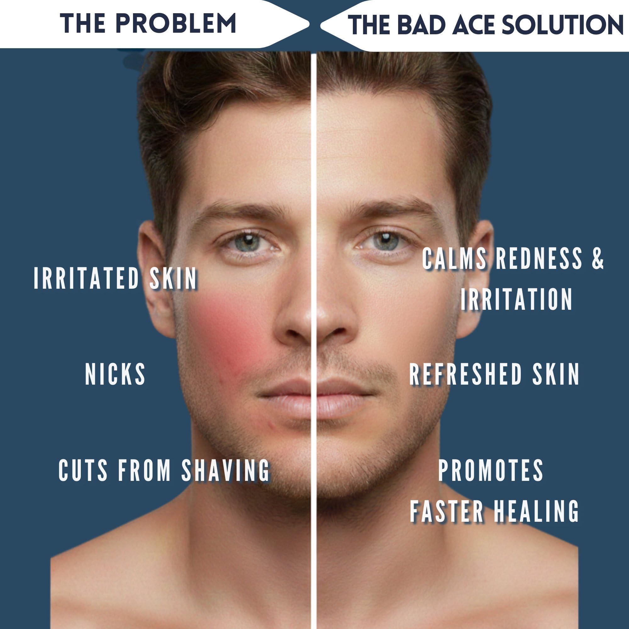 BAD ACE Aqua After Shave Balm for Men – Jeju Ocean Calms Razor Burn