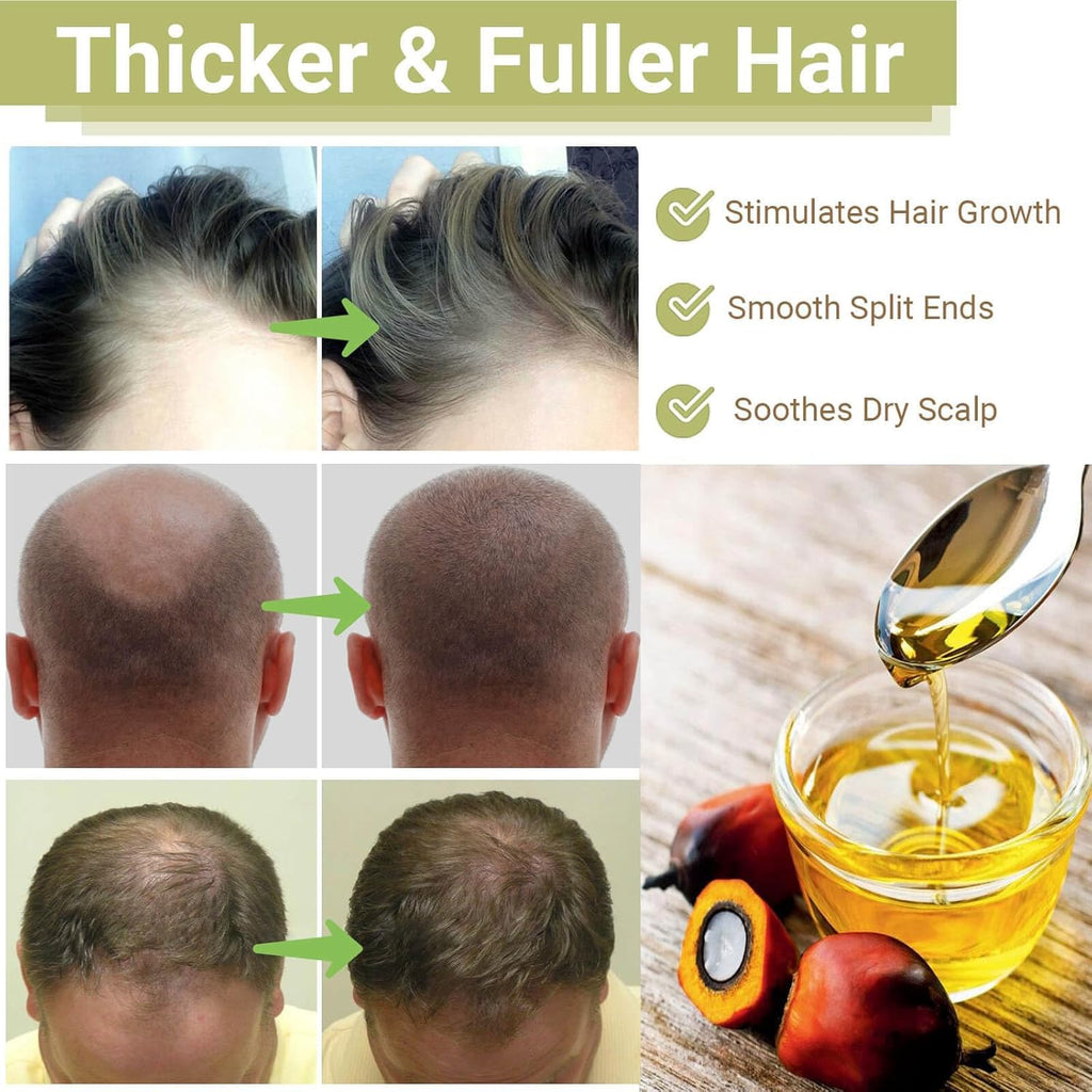 BALPPRD Lifewitqueenp Hair Growth Oil — Ayurvedic Care for All Hair Types