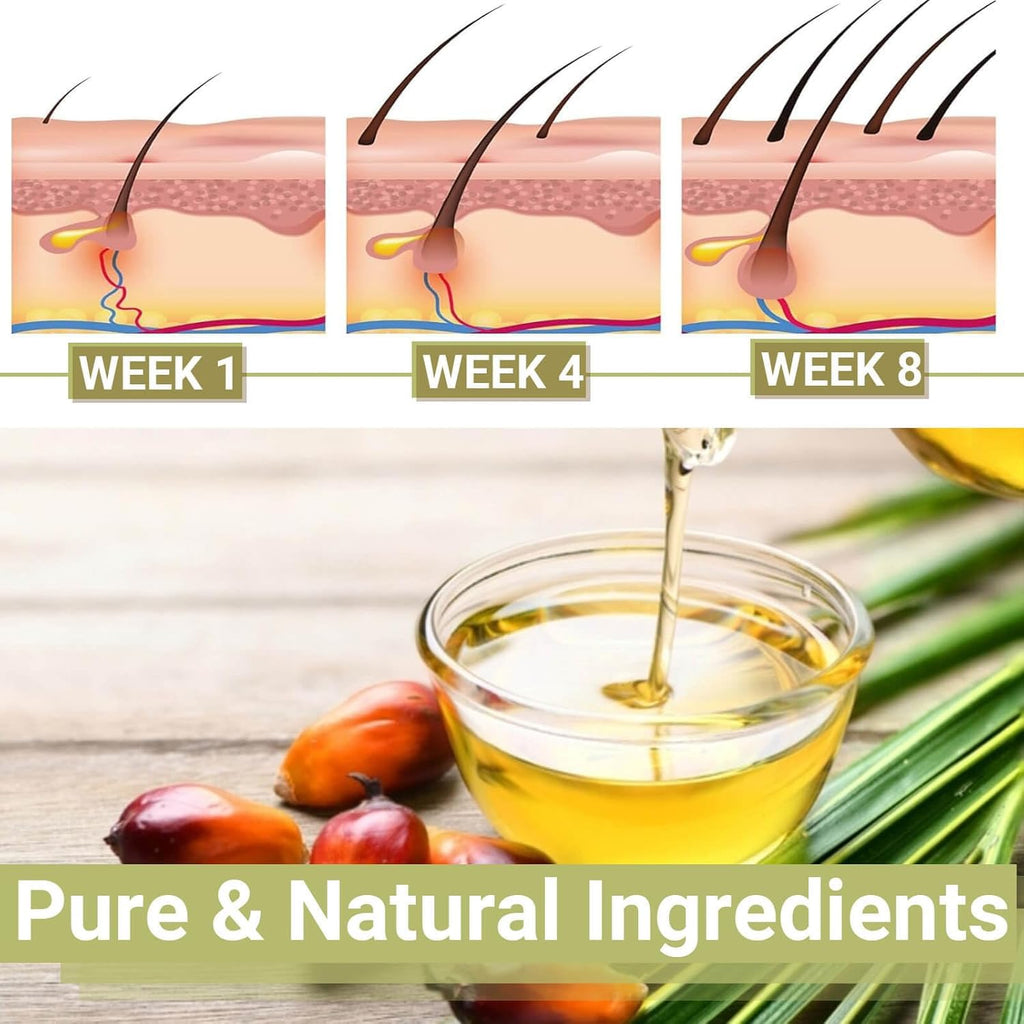 BALPPRD Lifewitqueenp Hair Growth Oil — Ayurvedic Care for All Hair Types