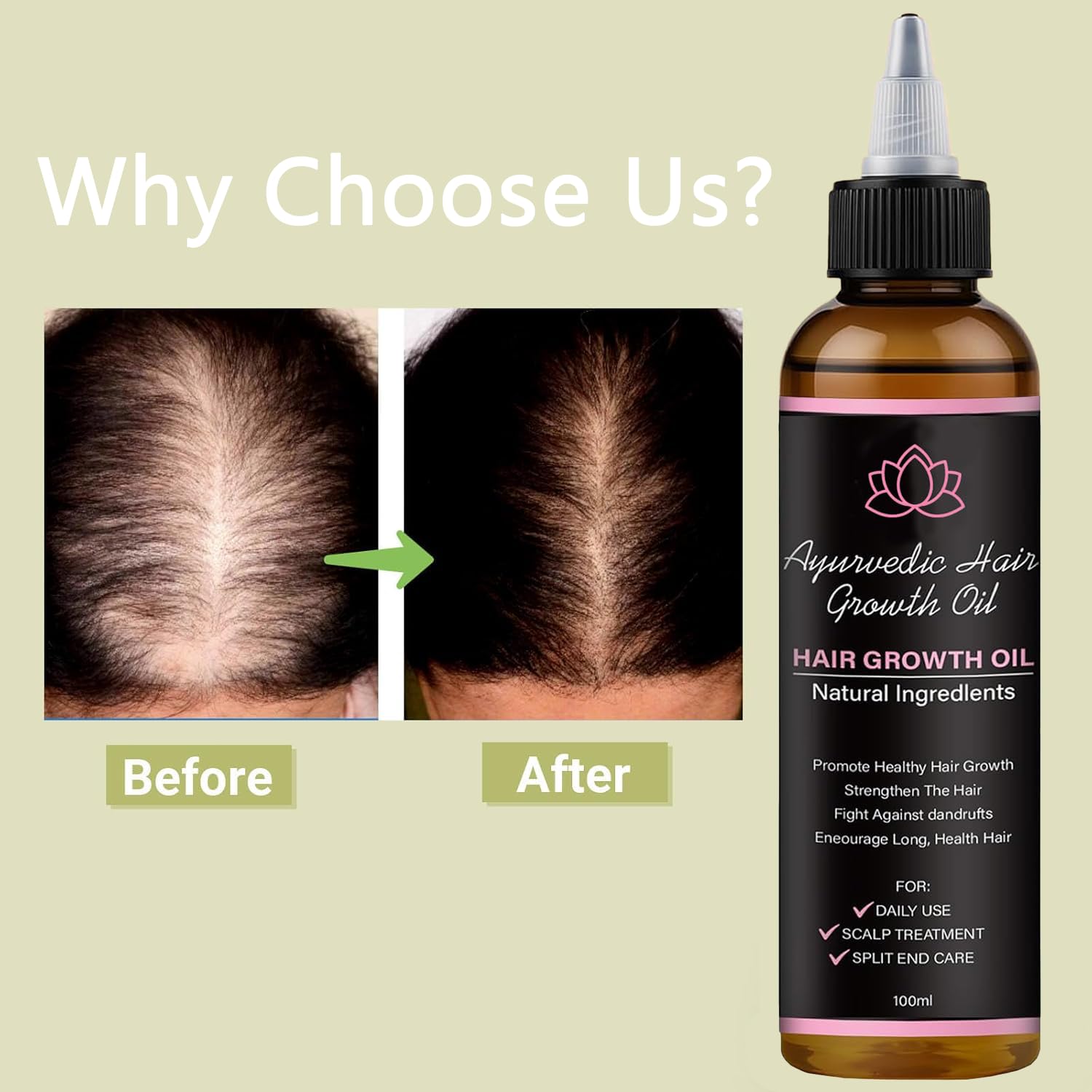 BALPPRD Lifewitqueenp Hair Growth Oil — Ayurvedic Care for All Hair Types