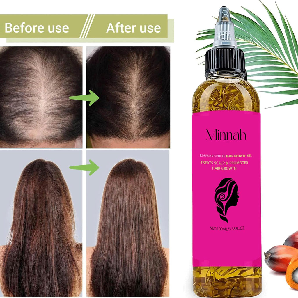 BALPPRD Minnah Batana Oil for Hair Growth – 4-in-1 Nourishing Hair Oil