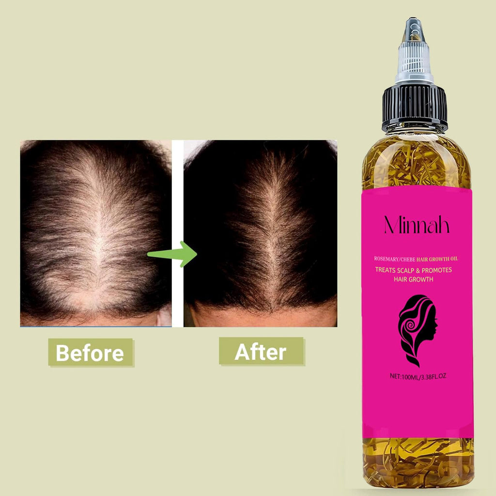 BALPPRD Minnah Batana Oil for Hair Growth – 4-in-1 Nourishing Hair Oil