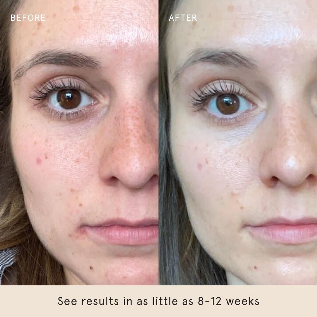Barefaced Hydrating Lotion 1.7 oz – Oil-Free Moisturizer with Niacinamide, Hyaluronic Acid & Ceramides