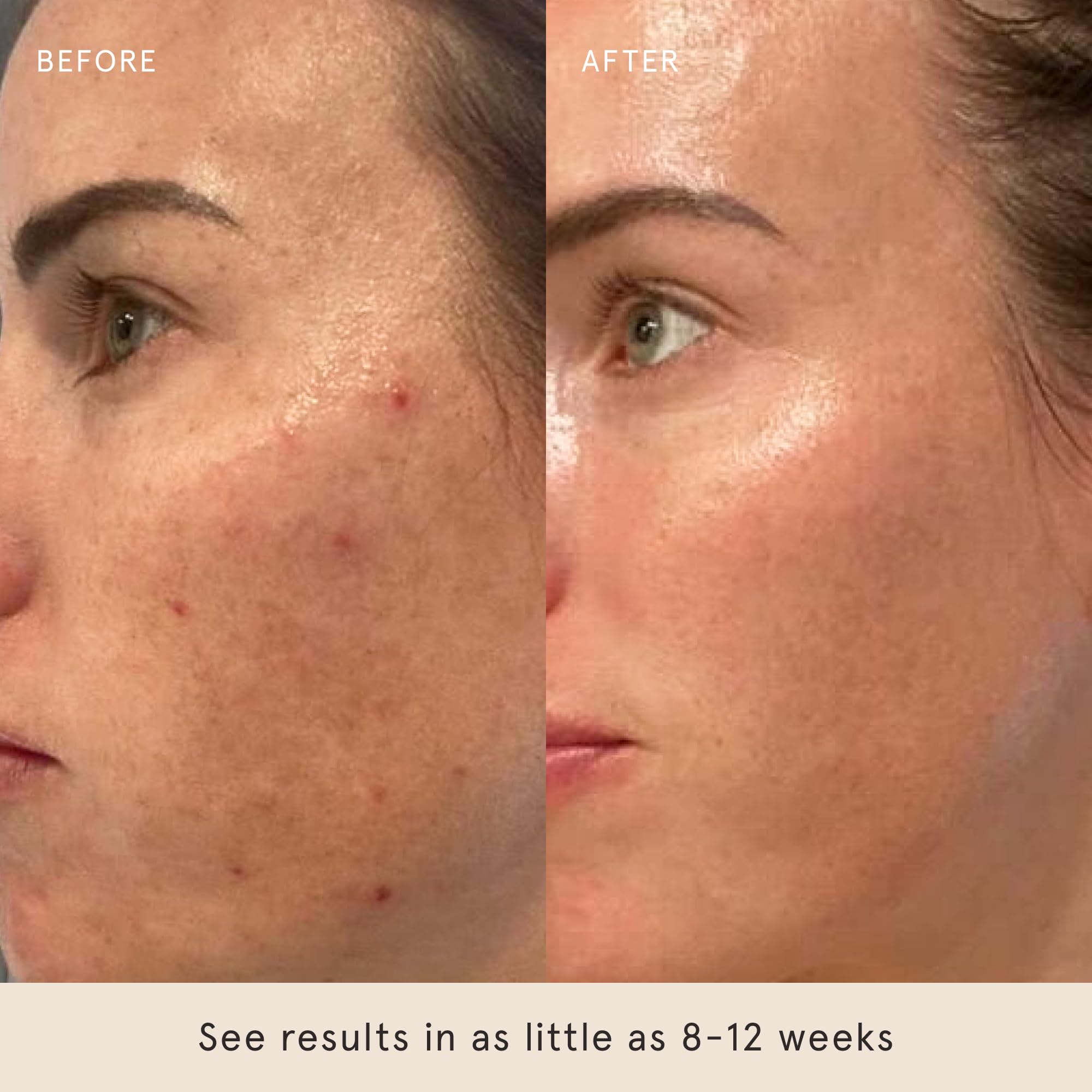 Barefaced Retinal Skin Therapy 30ml – Retinaldehyde & Bakuchiol Serum for Firming, Smoothing & Even Tone