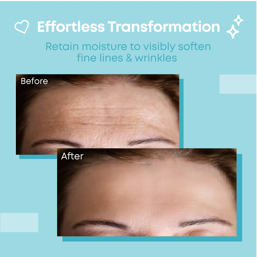 Bayside Forehead Wrinkle Patches – Reusable Non-Invasive Treatment with Storage Tin