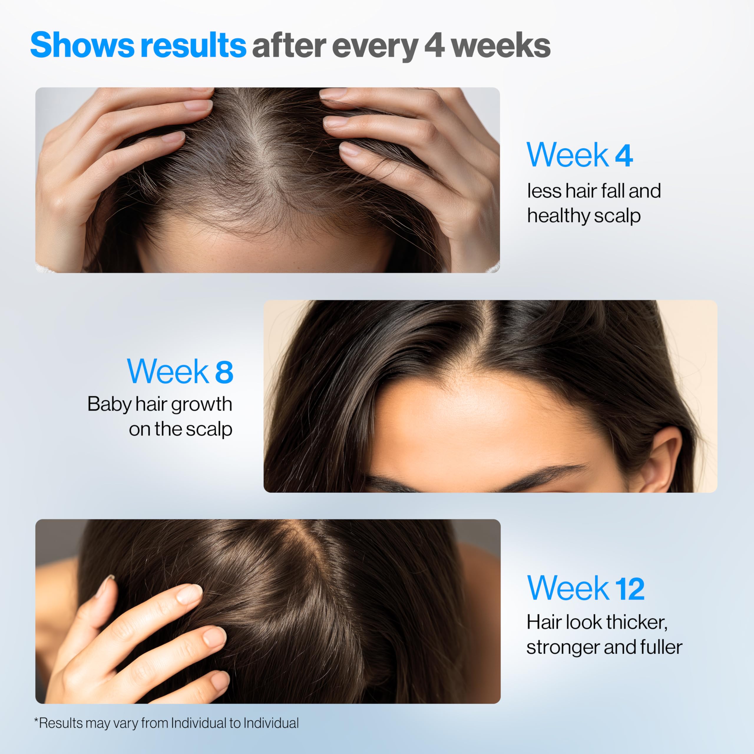 Be Bodywise Rosemary Hair Growth Serum Roll-On 25 ml | 3% Rosemary, 3% Redensyl & 2% Anagain | Paraben/Sulfate-Free