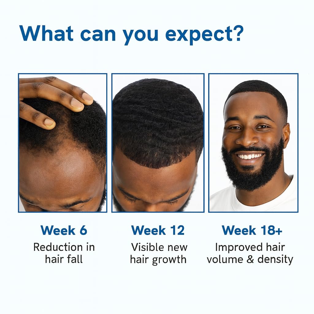 Be BodyWise Rosemary Hair Serum Roll-On 3% Rosemary for Thicker, Stronger Hair & Beard | 25ml | All Hair Types | TikTok Viral