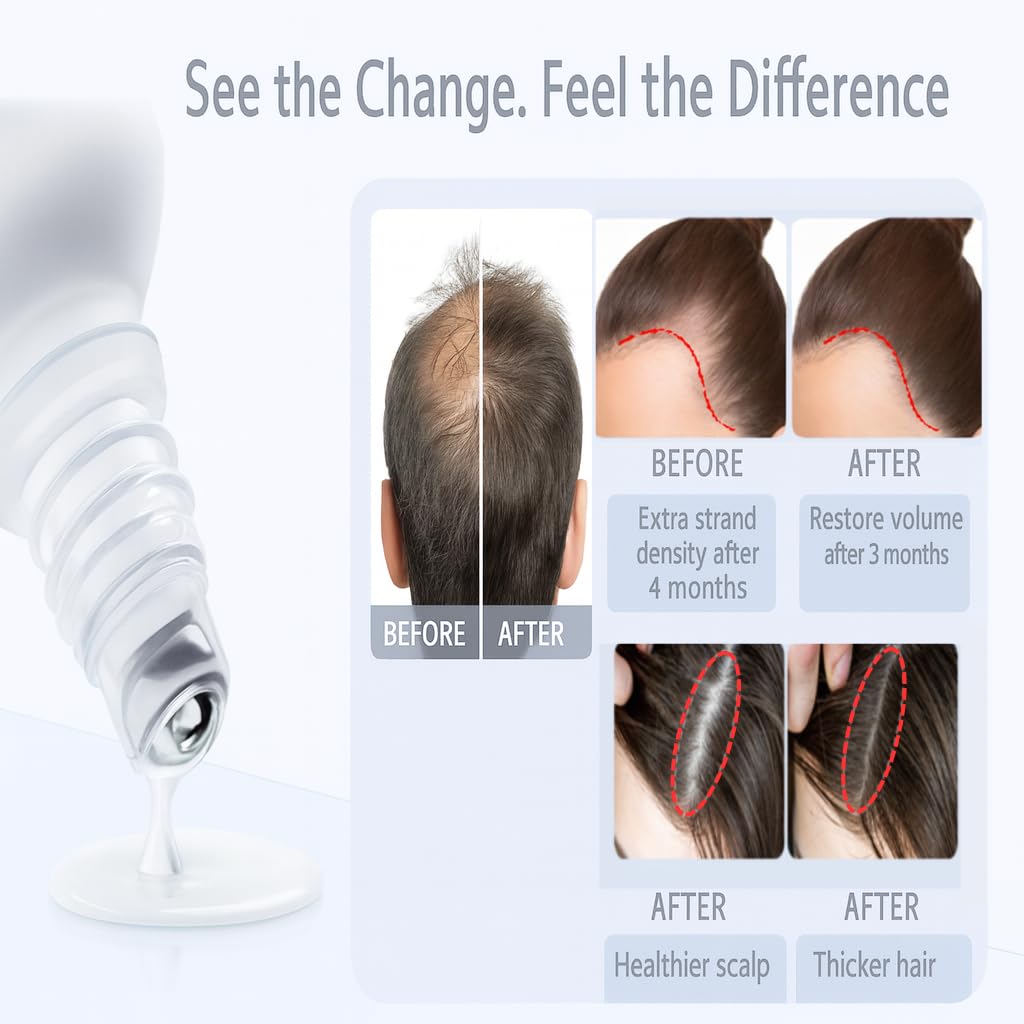 Be BodyWise Rosemary Hair Serum Roll-On 3% Rosemary for Thicker, Stronger Hair & Beard | 25ml | All Hair Types | TikTok Viral