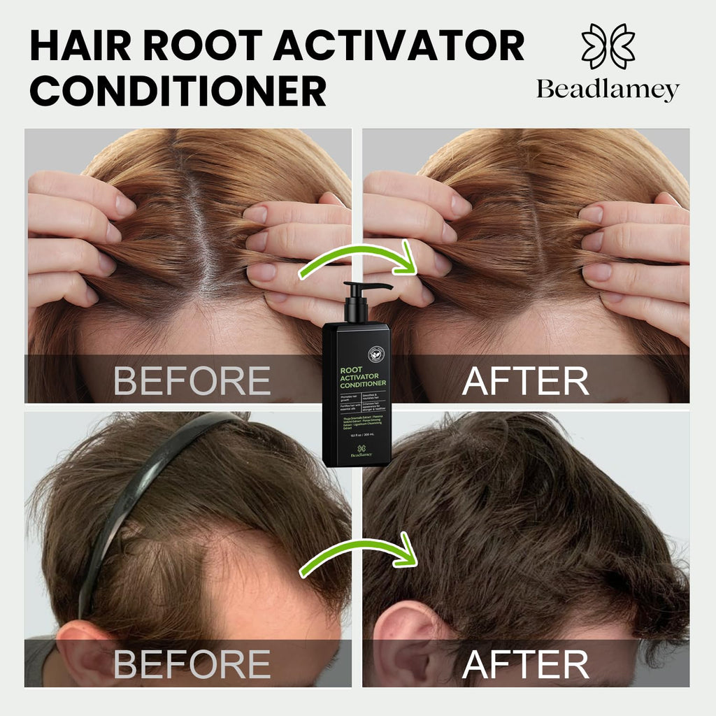 Beadlamey Root Activator Conditioner – Hair Growth for Men & Women, 10.1 fl oz