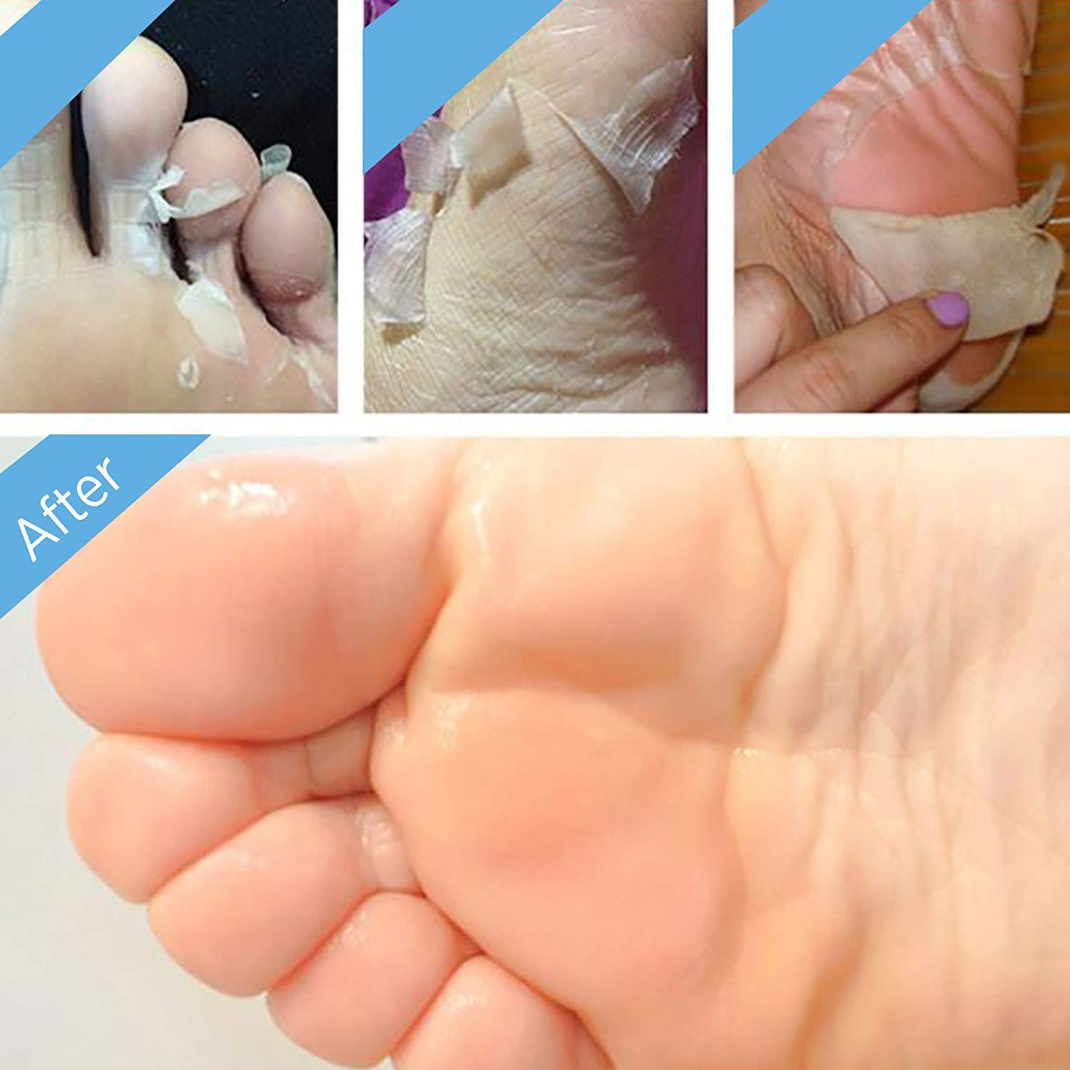 Bealuz Foot Peel Mask – 2 Pairs Exfoliating Booties for Softer Feet in 1-2 Weeks (Lavender)