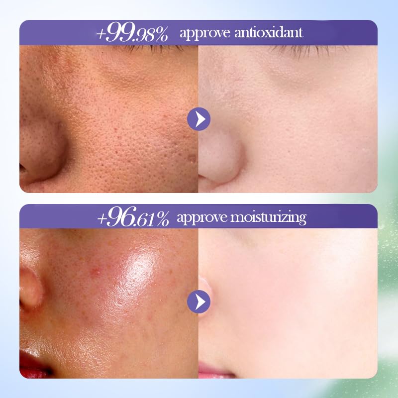 BeauBase Blueberry Skin Care Set (6 PCS) – Nourishing & Hydrating Routine