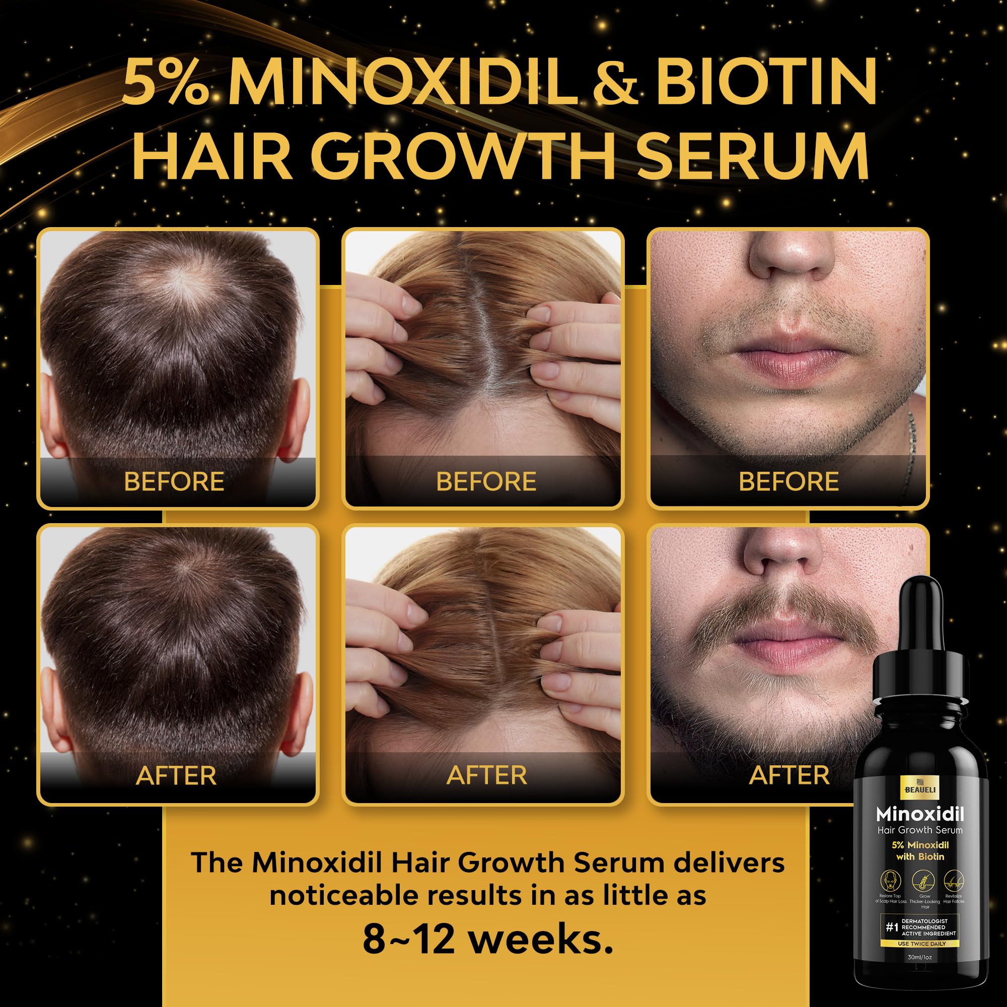 Beaueli 5% Minoxidil for Hair & Beard Growth — Unscented Foam, 3 x 3oz