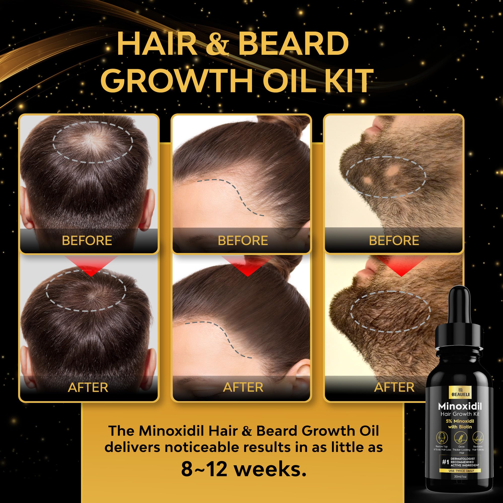 Beaueli Minoxidil Beard Growth Kit 5% for Men & Women | Hair Growth