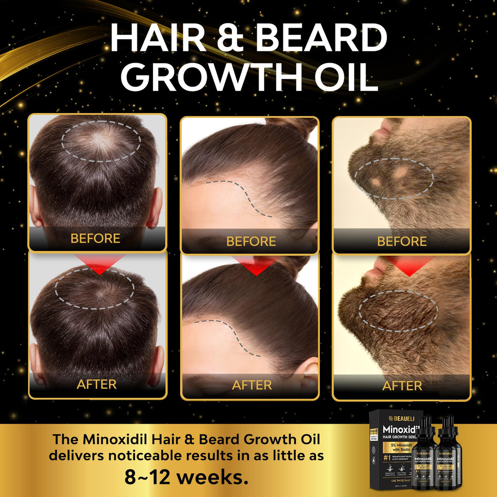 Beaueli 5% Minoxidil Hair Growth Serum for Men & Women — Extra Strength Beard & Hair Regrowth with Biotin, 8 FL OZ (4 bottles)