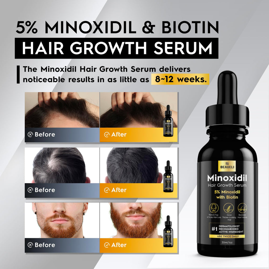 Beaueli 5% Minoxidil Hair Growth Serum for Men & Women – 3x30ml Pack