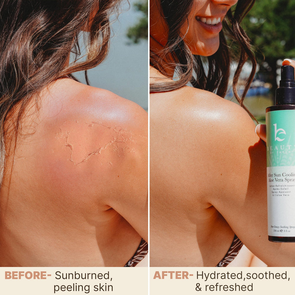 Beauty by Earth After Sun Cooling Aloe Vera Spray – USA Made Sunburn Relief