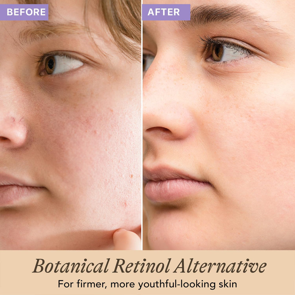 Bakuchiol Serum - Plant-Based Retinol Alternative for Smoother Skin | Beauty by Earth