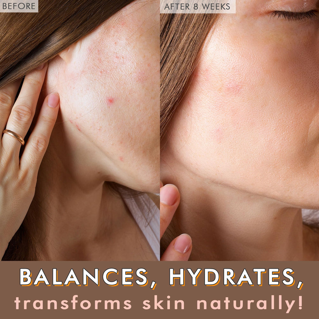 Beauty by Earth USDA Organic Face Oil - USA Made for Acne-Prone & Oily Skin