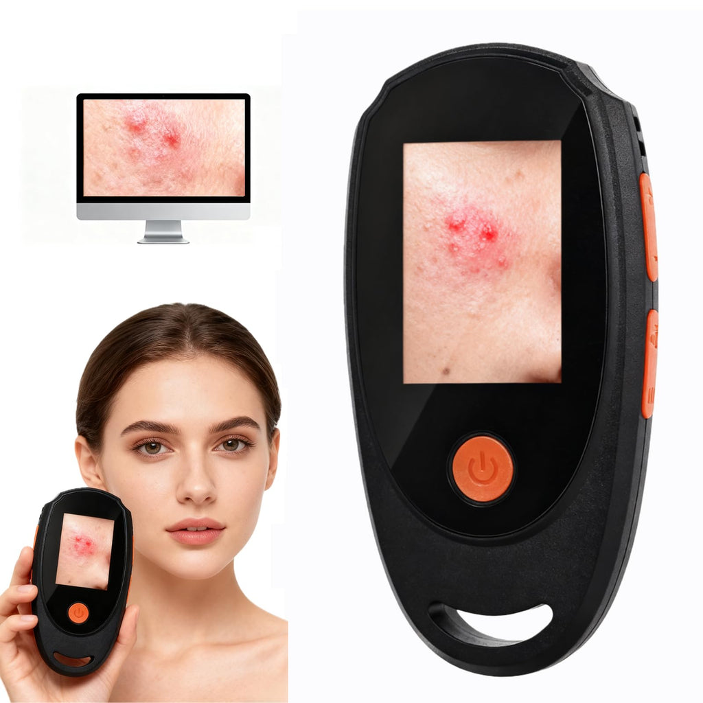 Beauty Star Dermatoscope 500x – Handheld Skin & Scalp Microscope, 8 LED, 1080P Display