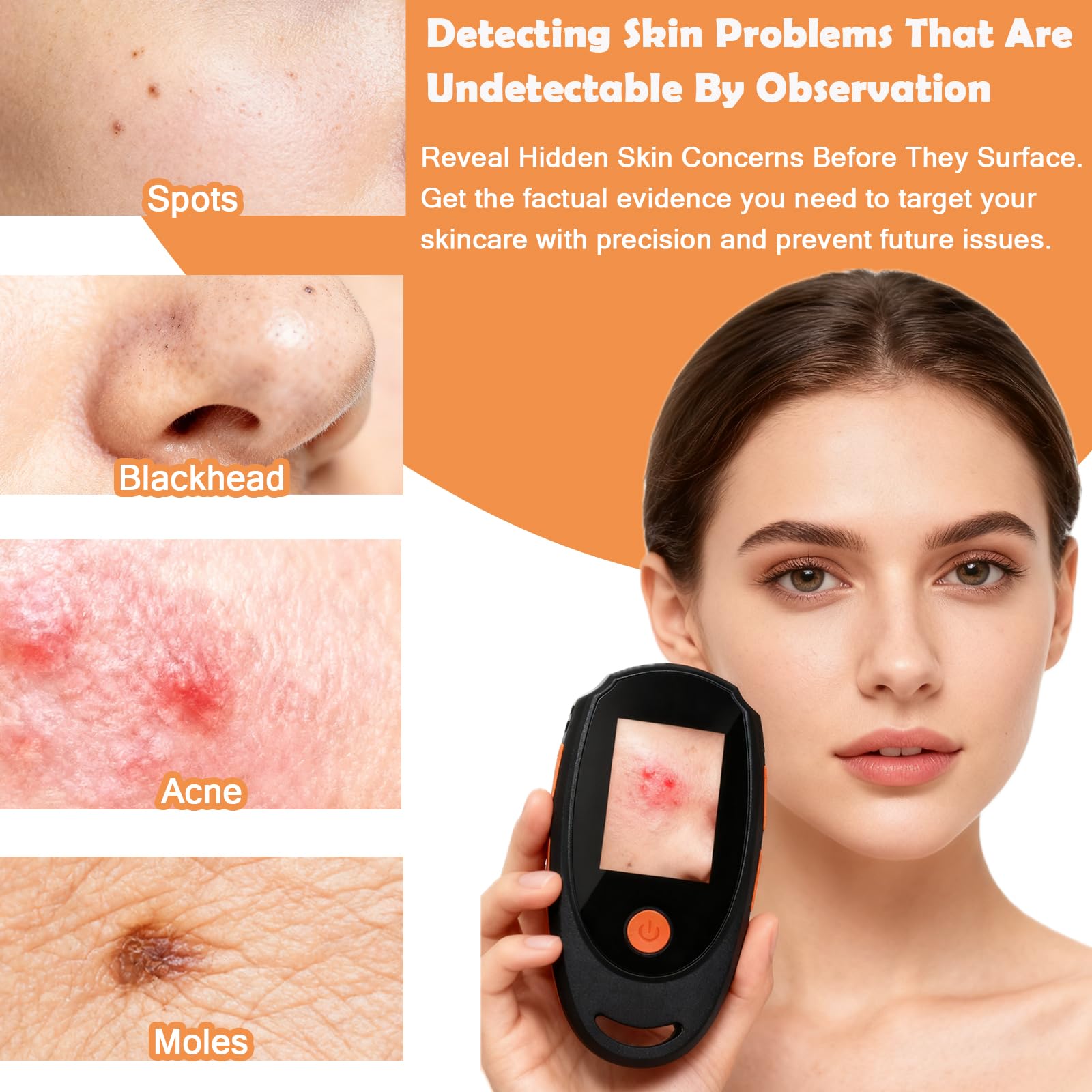 Beauty Star Dermatoscope 500x – Handheld Skin & Scalp Microscope, 8 LED, 1080P Display