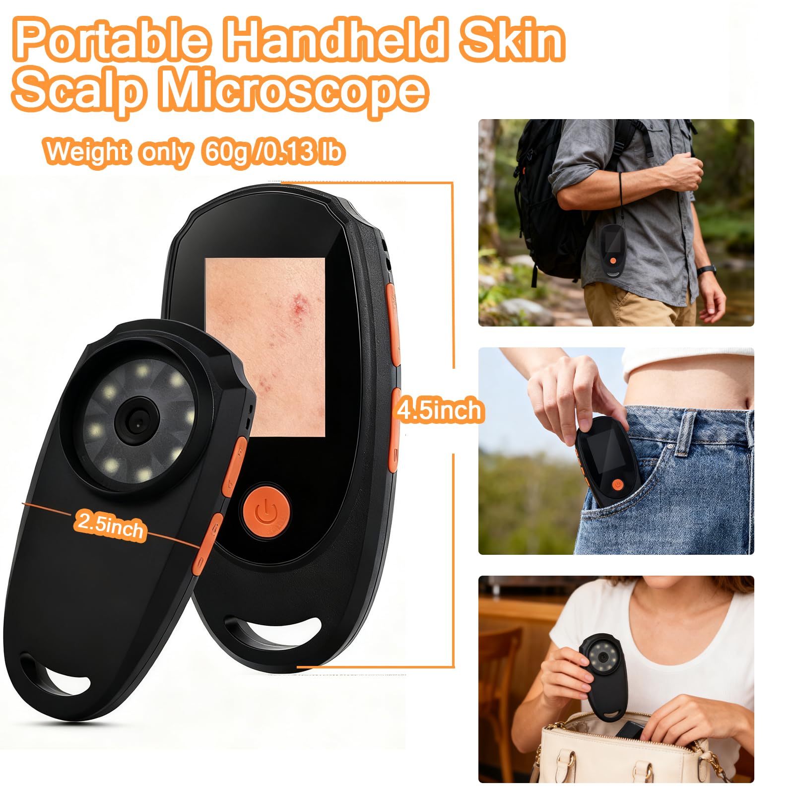 Beauty Star Dermatoscope 500x – Handheld Skin & Scalp Microscope, 8 LED, 1080P Display