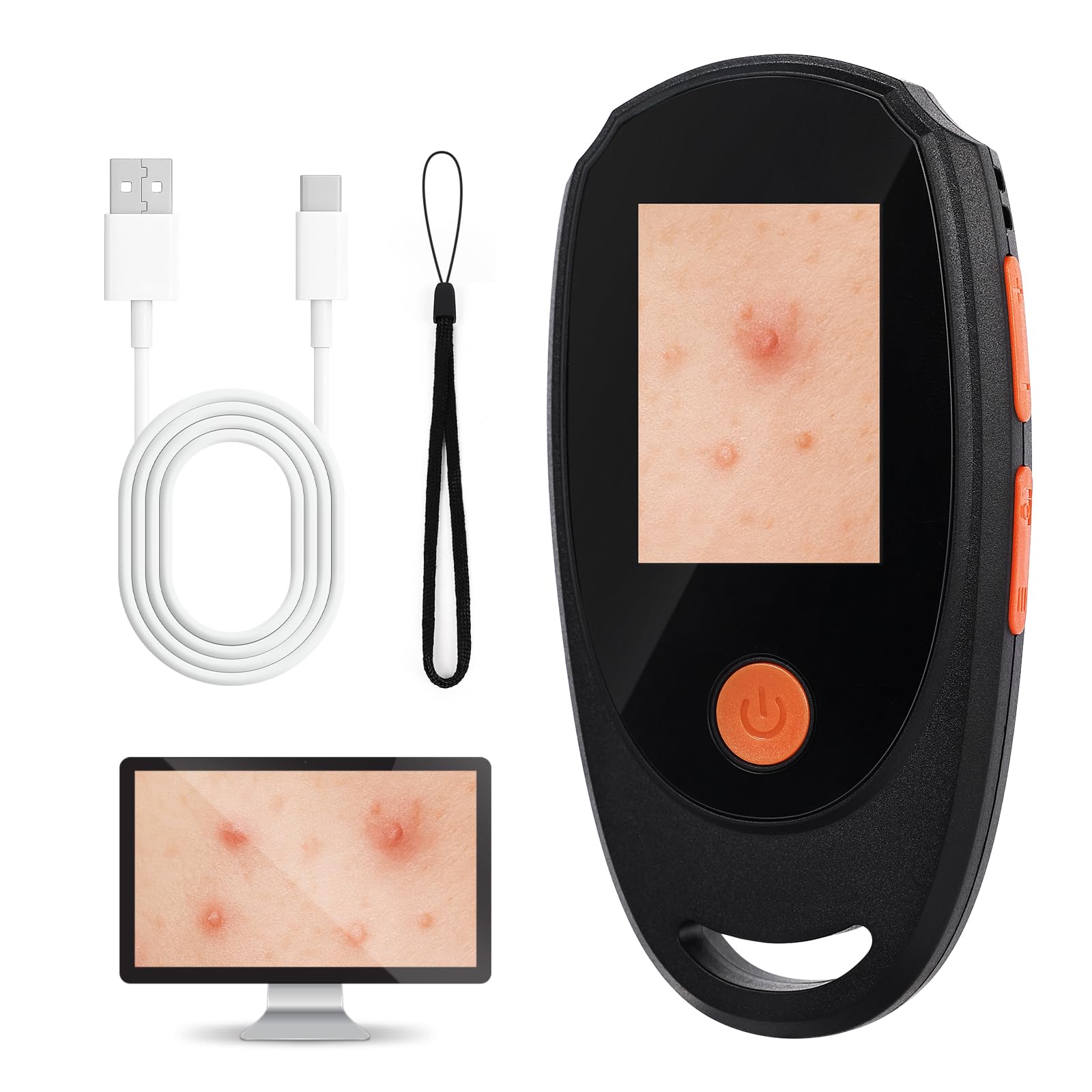 Beauty Star Dermatoscope 500x – Handheld Skin & Scalp Microscope, 8 LED, 1080P Display