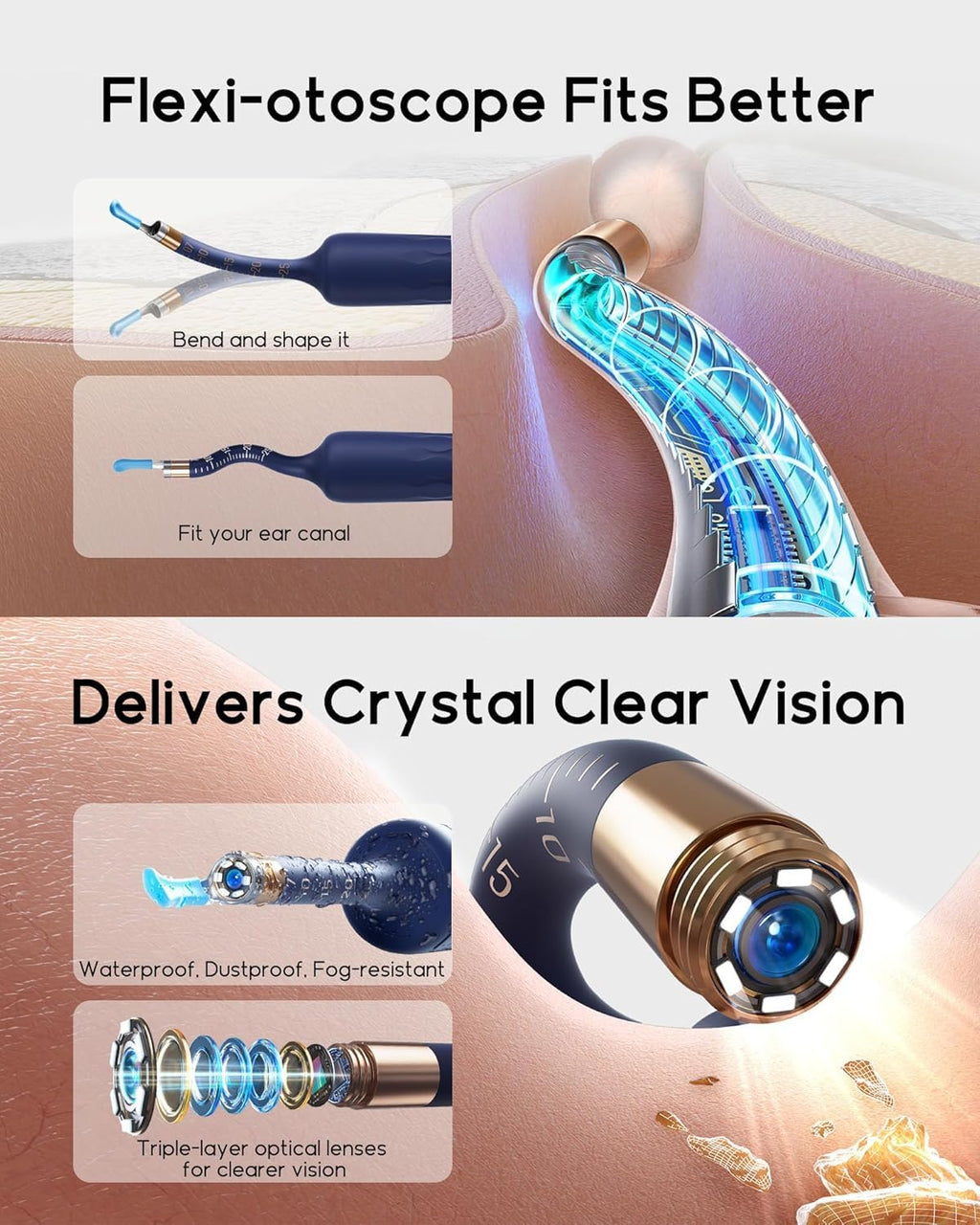 BEBIRD Earsight Plus D39R Ear Camera & Wax Remover | Family Ear Cleaning Kit (FSA/HSA Eligible)