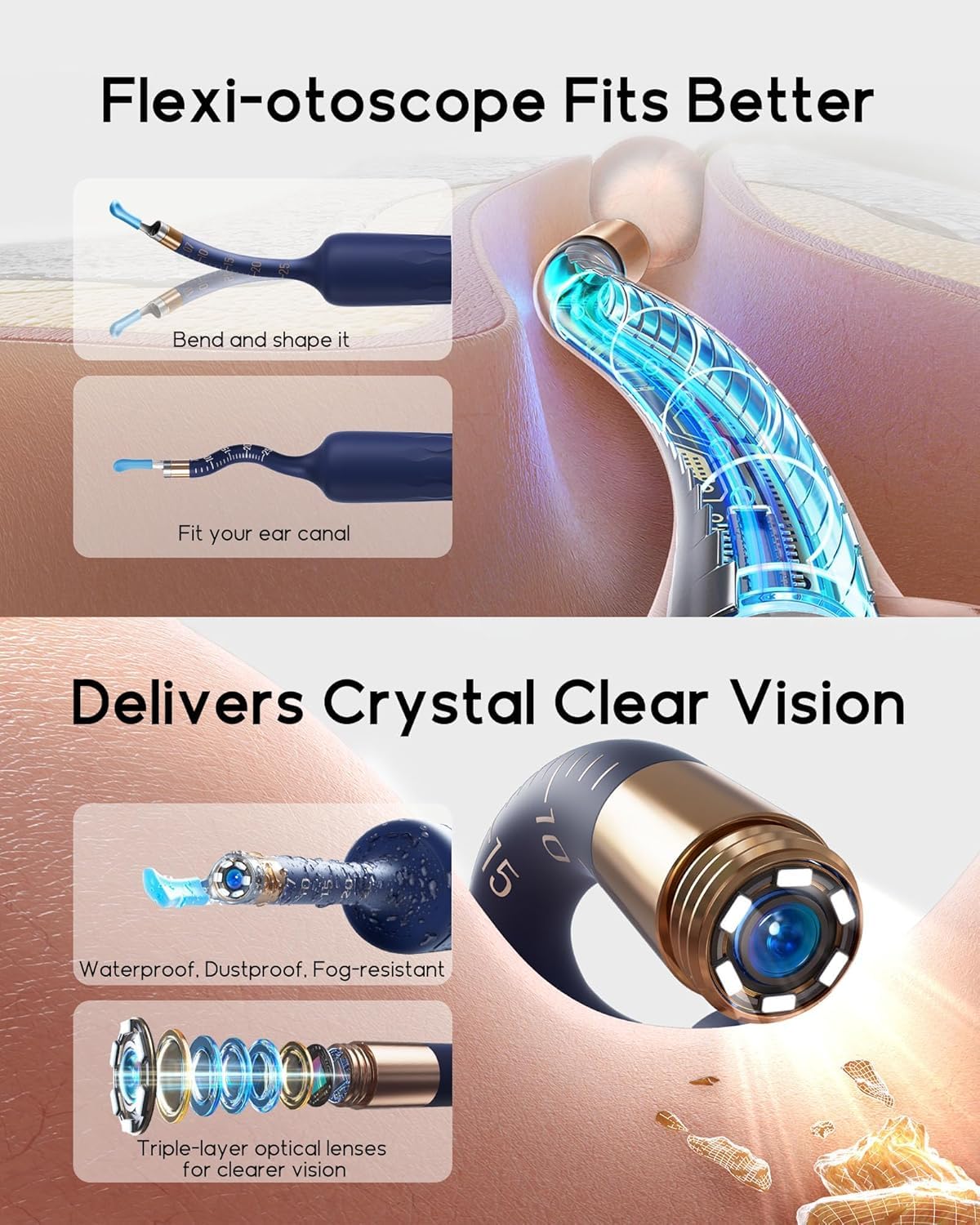 BEBIRD Earsight Plus D39R Ear Camera & Wax Remover | Family Ear Cleaning Kit (FSA/HSA Eligible)
