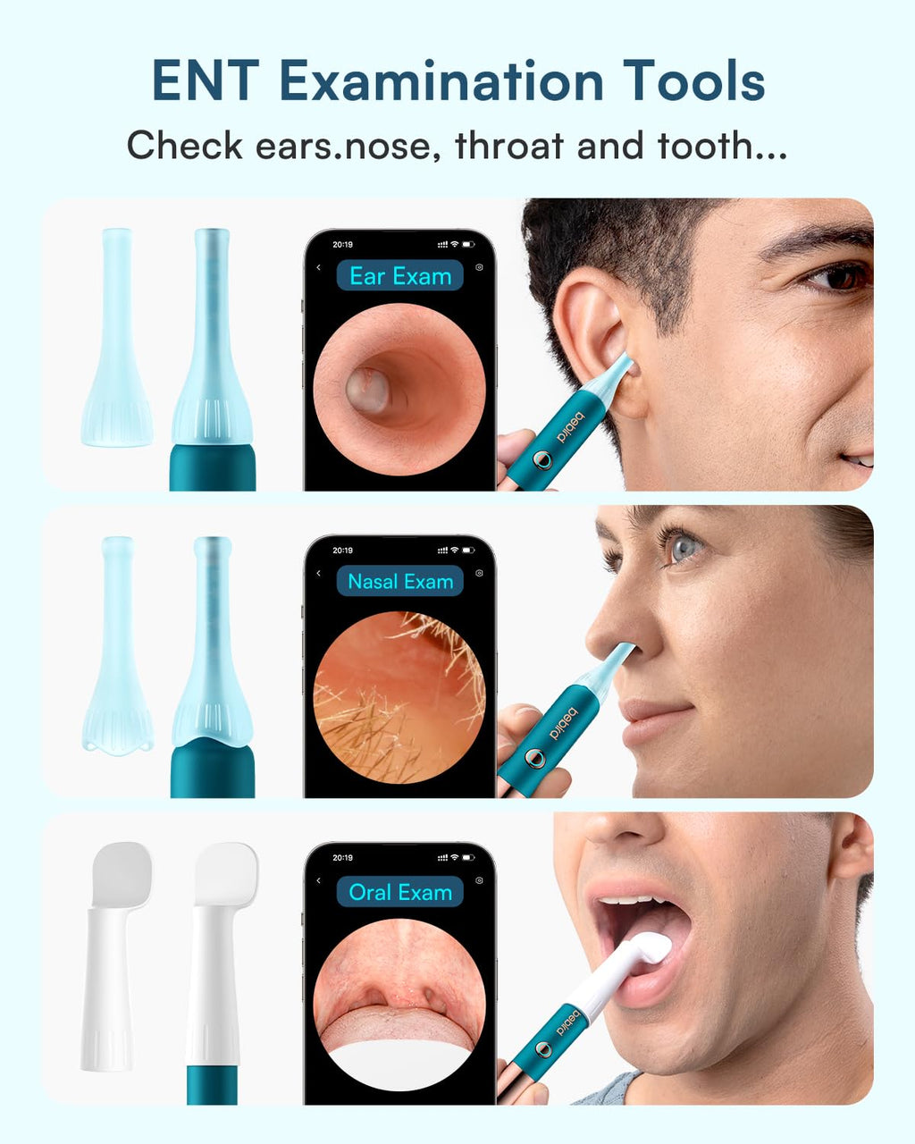 BEBIRD Earsight Ultra Ear Wax Removal Kit with 2K HD Camera | 90-Min Battery, Visual Ear Cleaner