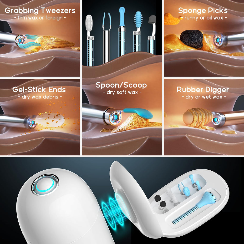 BEBIRD Home 30S Ear Care System – Flexible Scope, UVC Light & Visual Ear-Drops Kit