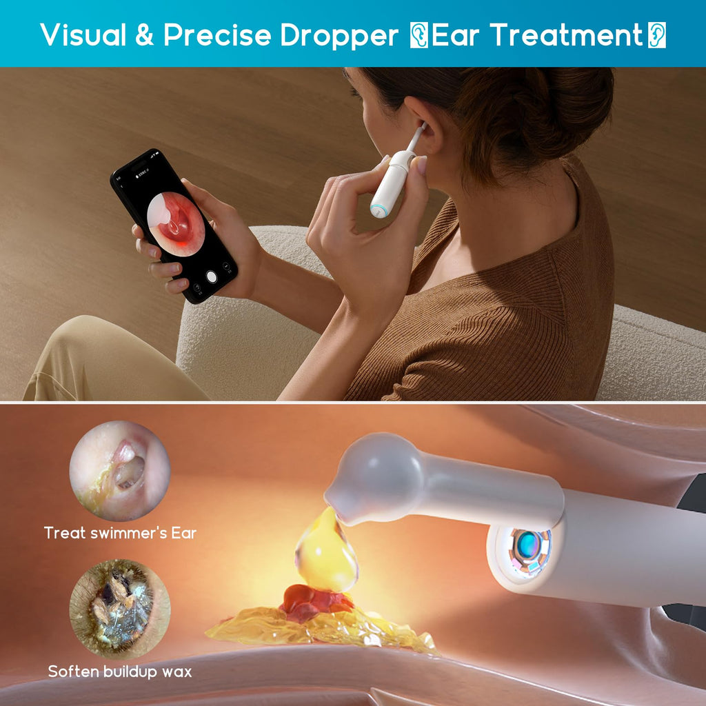 BEBIRD Home 30S Ear Care System – Flexible Scope, UVC Light & Visual Ear-Drops Kit