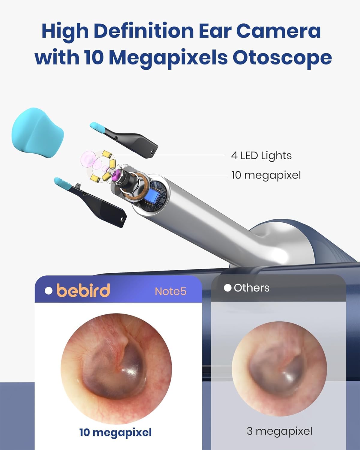 BEBIRD Note5 Ear Camera Wax Removal — 10MP Ear Otoscope with Camera, 12 Silicone Ear Spoons