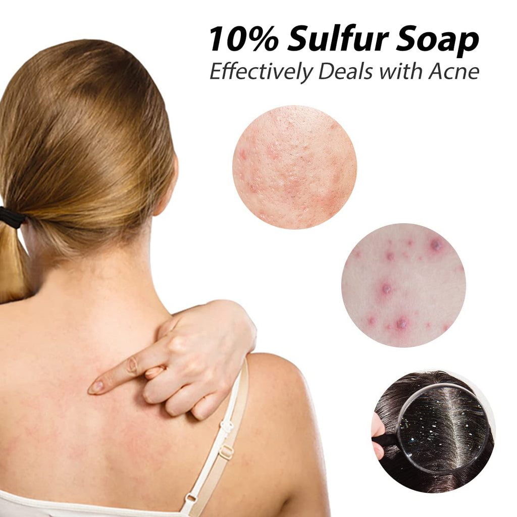 Bee & Flower Shanghai Sulfur Soap 10% 4-Pack – Acne-Prone Skin Deep Clean 3.4 oz Bars