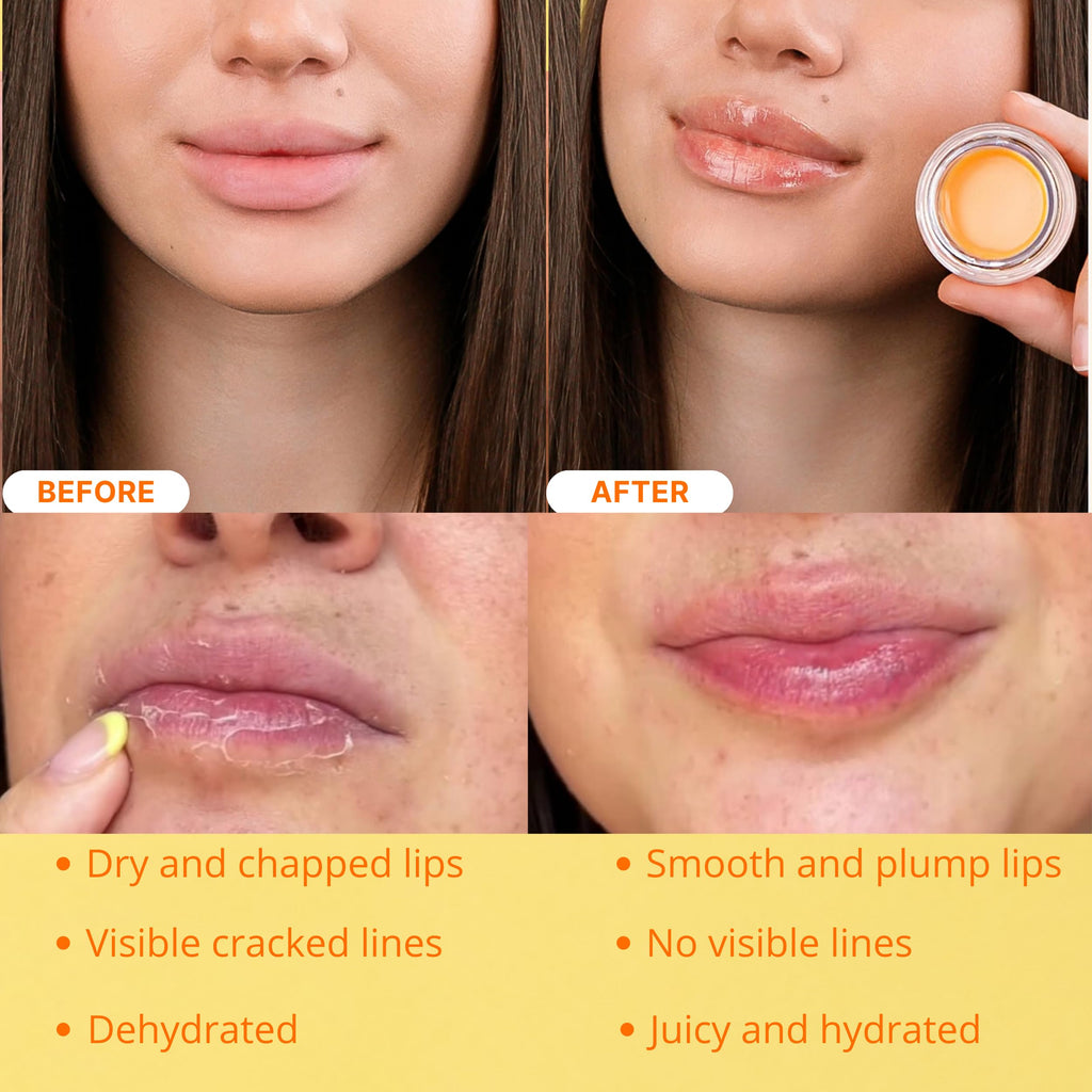 Bee Balm Original Peach Lip Balm – Hydrating Honey Pot with Propolis, Honey & Vitamin E (Pack of 2)